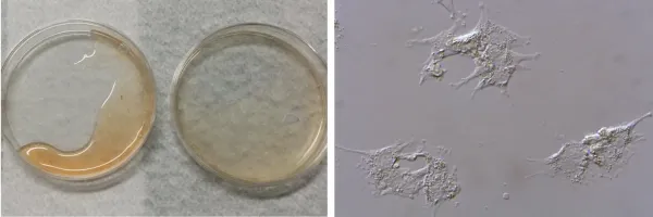 En mogen äggstocksfollikel innehåller follikelvätska. Foto: Pauliina Damdimopoulou och Jie Hao.