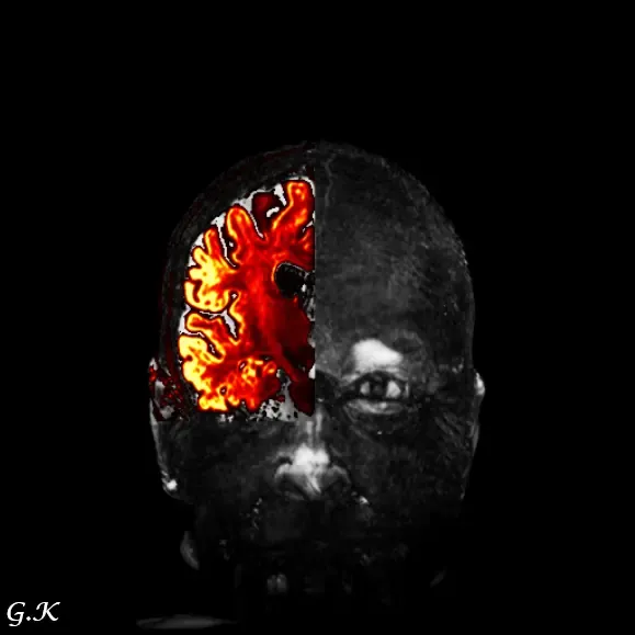 Art: decorative images created using MRI