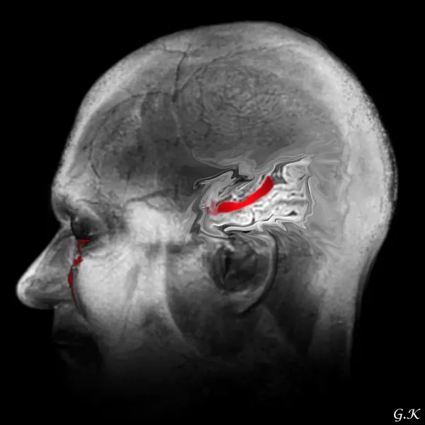 Art: decorative images created using MRI