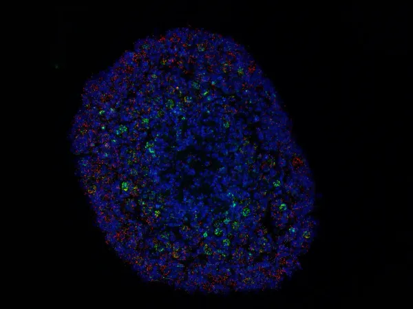 Image of Multiplex RNAScope - Puma (Green), Pten (Red), Nucleus (Blue), juvenile mouse ovary