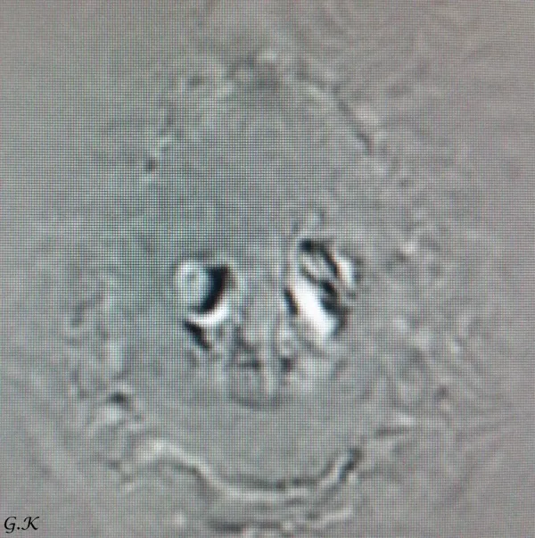 Art: decorative images created using MRI