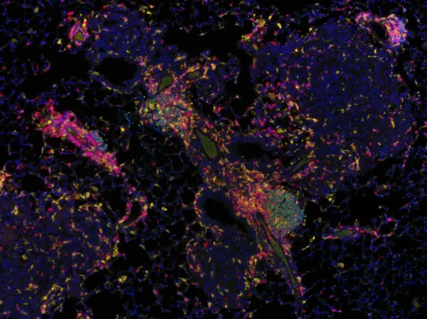 Image of Opal 4-color - CD3 - (Red), Iba1 (Yellow), PAX5 (Green), Nucleus (Blue), Mouse lung