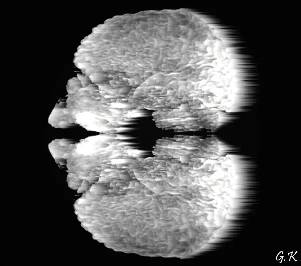 Art: decorative images created using MRI