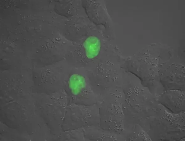 Image from Biomedicum Imaging Core. Credit: Florian Salomons.