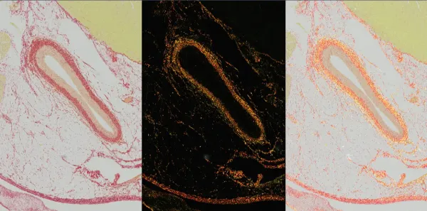 Image of Sirius Red staining - Bright Field & polarization, Heart
