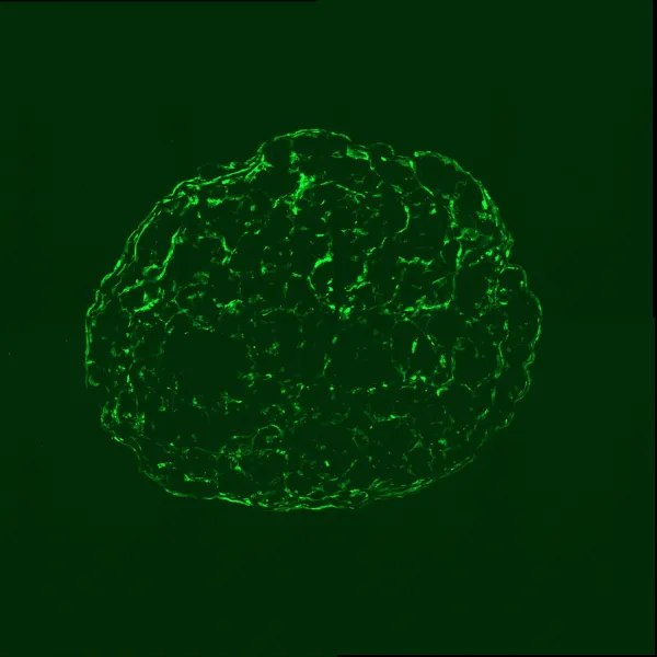 Image of Spheroid with GFP expression, frozen section