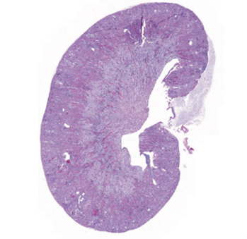 Graphical illustration of Staining profile: PAS.