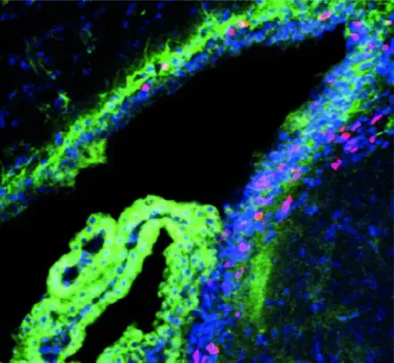 Choroid plexus extracellular veiscles carry signalling molecules to the subvenricular zone via cerebrospinal fluid.