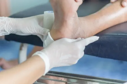 Hands treating a foot wound.