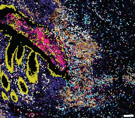 Coloured dots in an indeterminate pattern indicate different proteins in a tissue sample.