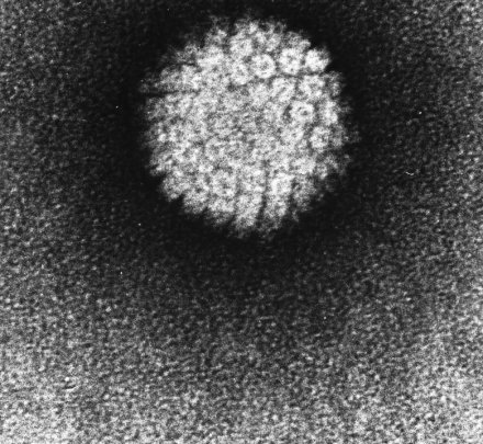Image of a human papilloma virus.