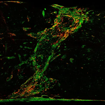 Microscopy image of fibrotic scar tissue after spinal cord injury