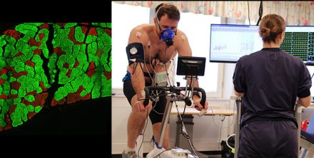235 / 5,000 Two side-by-side photographs, one of which shows a section of muscle stained with immunohistochemistry, showing which muscles are fast and slow. The second image shows a test subject doing a work test on a test cycle.