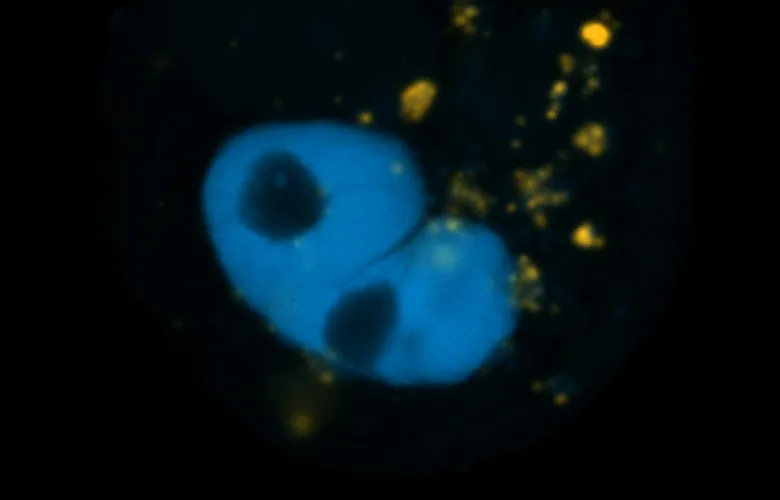 In situ hybridization performed in human primary keratinocytes Enikö Sonkoly&#039;s Lab, Dept. of Medicine Karolinska Institutet. Credit: Lorenzo Pasquali.  Microscope: Zeiss LSM800 (60x).