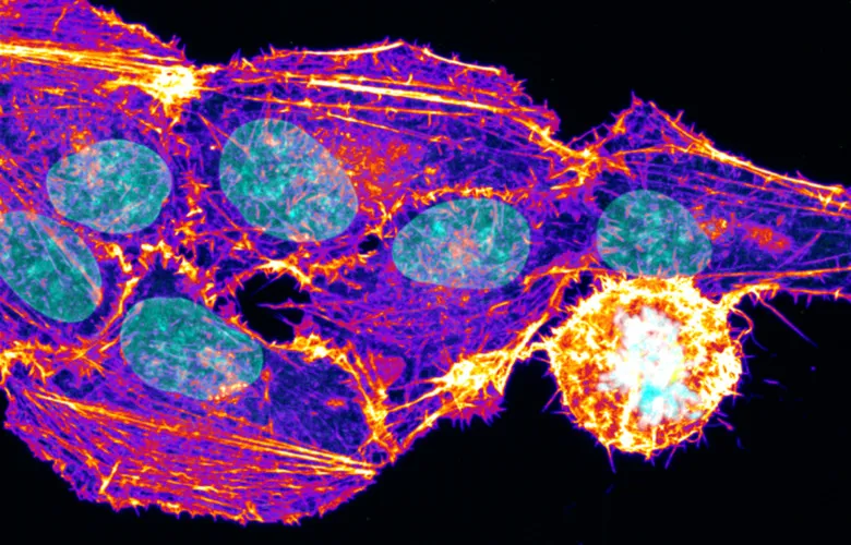 Imaging live cells, image from Biomedicum Imaging Core (BIC). Credit: Florian Salomons.